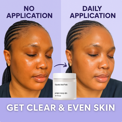 Radiant Glow Exfoliating Pads