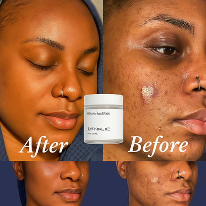 Radiant Glow Exfoliating Pads